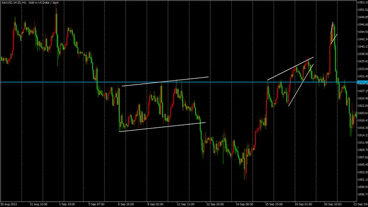 楔形過高 H1時區