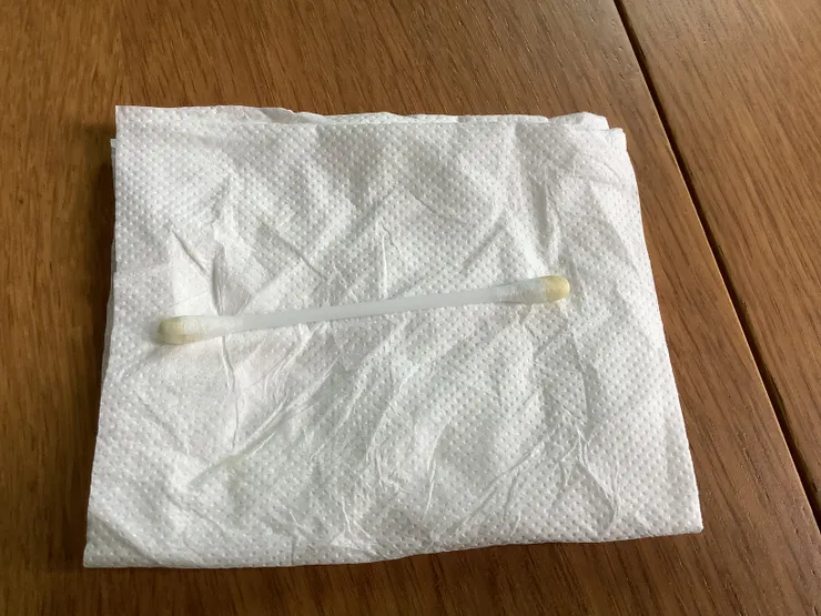 圖二：與圖一比較，幾天後，說明耳出血已經停止喔！