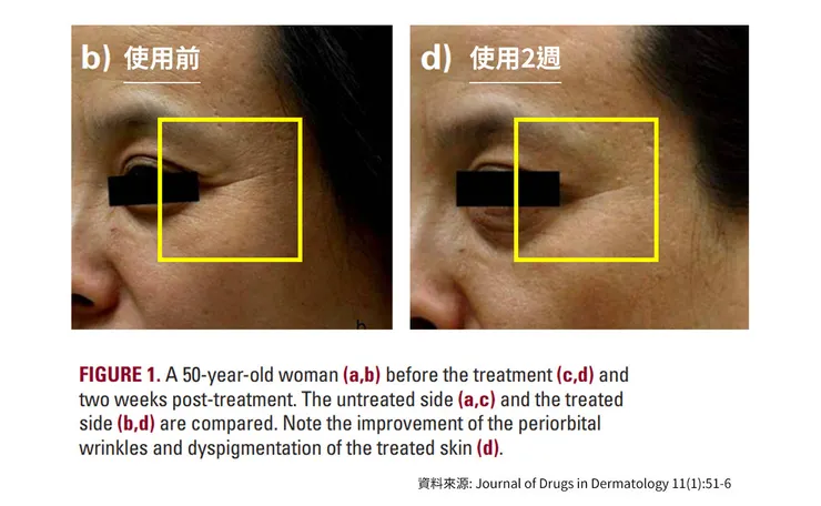早C晚A 誰重要？兩大時機深入挑戰「早C好處」的保養計畫