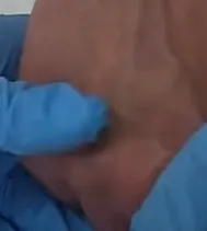 選定了這條靜脈