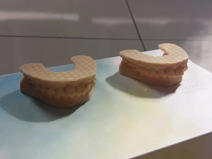 這一盒牙套戴完之後的齒模對比，左邊是這盒戴完後的樣子，右邊是還沒戴之前的樣子