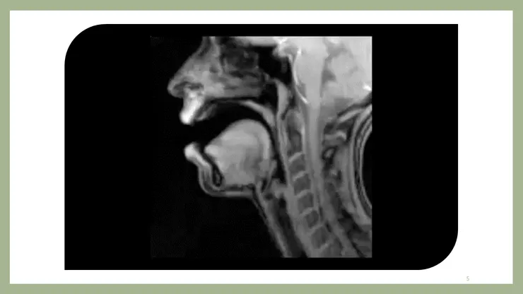  MRI核磁共振下發聲的口腔內部動作