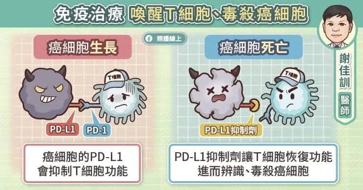 免疫治療喚醒T細胞、毒殺癌細胞