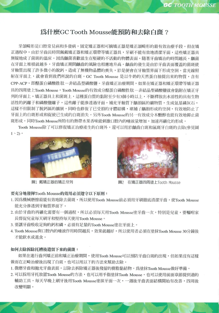 對刷牙不夠乾淨所造成的脫鈣白斑的效果，脫鈣的下一步就是蛀牙，正畸是大陸用語（就是台灣講的牙齒矯正，傳統矯正器期間，每吃必塞，所以注意刷牙乾淨是很重要的）