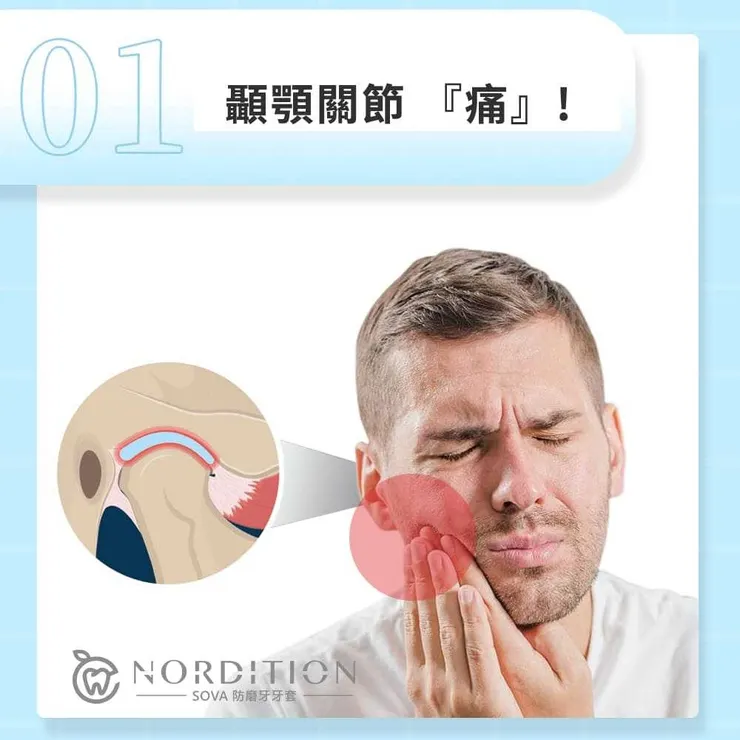 SOVA®️防磨牙牙套小教室 ◤ 顳顎關節哪裡痛 ◢