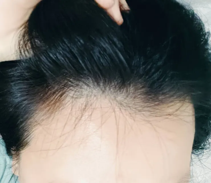 天生額頭就比別人高😓