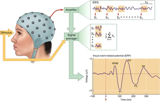 事件相關電位 ERP