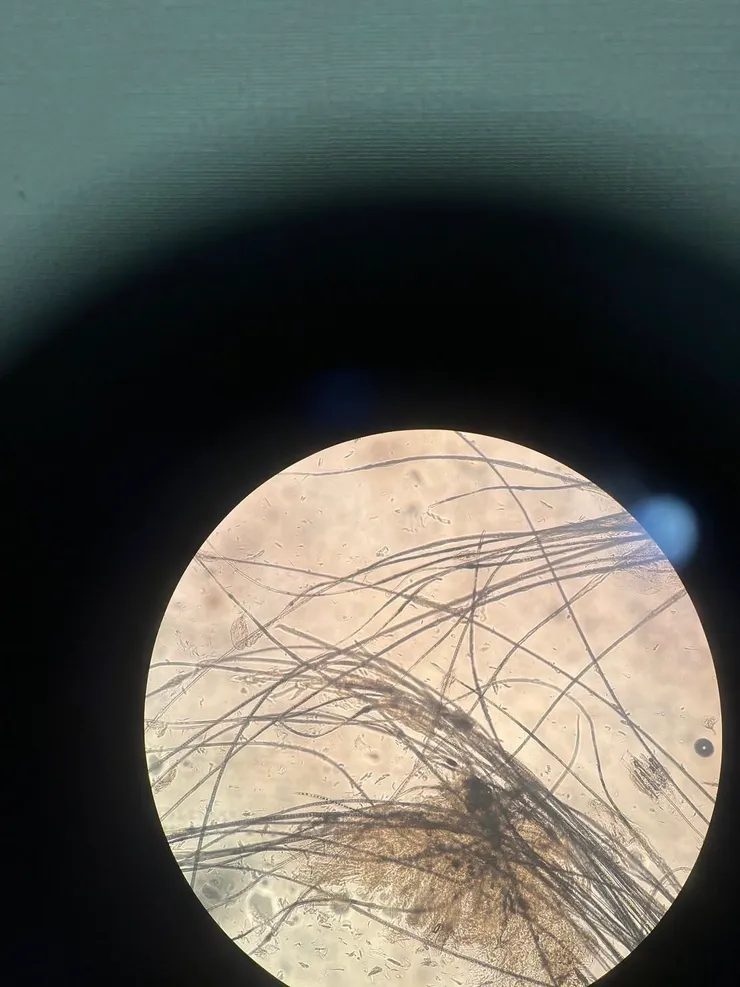 114/07/01八點皮檢發現黴菌