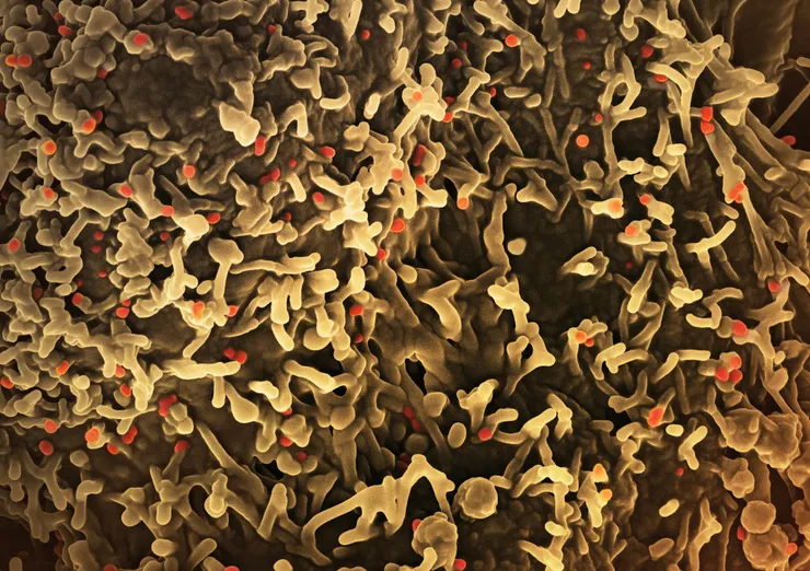 Photo by National Institute of Allergy and Infectious Diseases on Unsplash