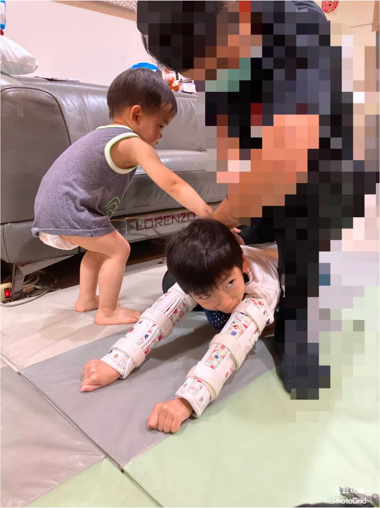 右手上穿戴的也是輔具~副木。