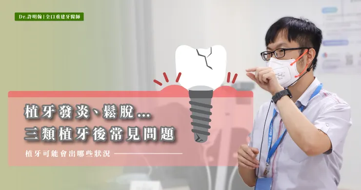 植牙鬆脫發炎?植牙後遺症有哪些？