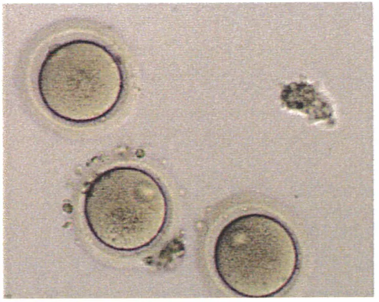 這就是我的卵子啦！圓滾滾的還是蠻可愛的齁XDD