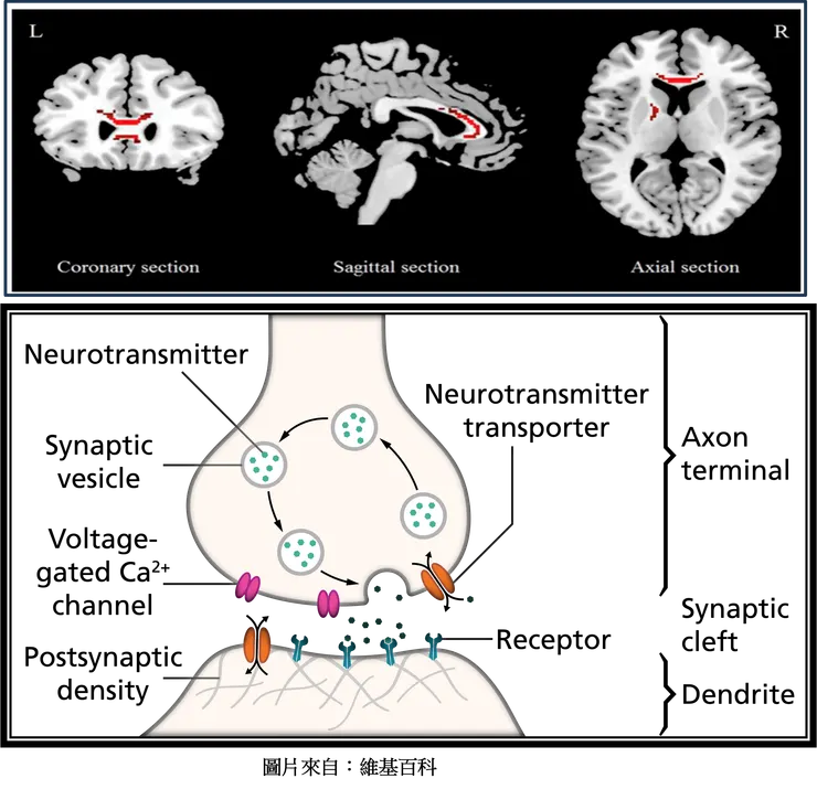 憂鬱患者大腦其它病理變化