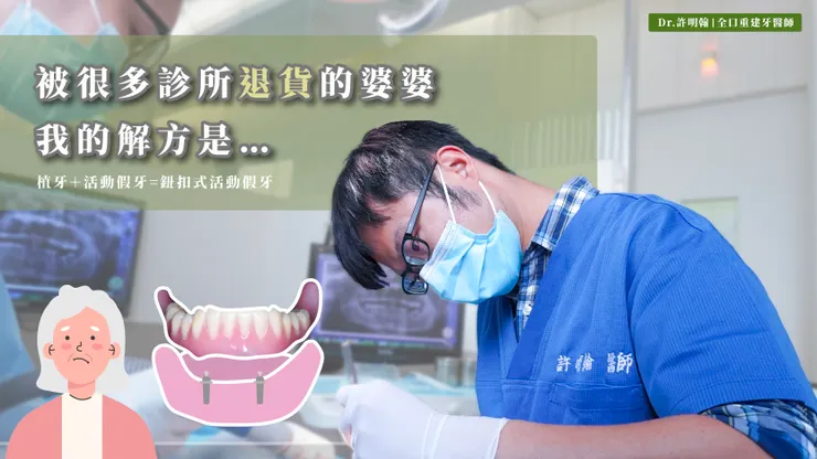 單顎活動假牙＋植體=鈕扣式活動假牙、覆蓋式活動義齒