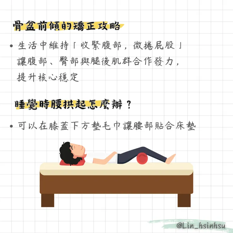 骨盆前傾矯正方式