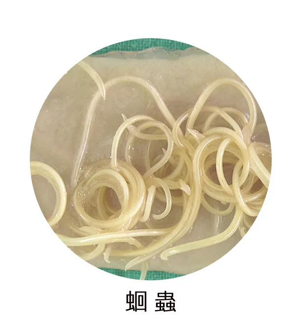 蛔蟲