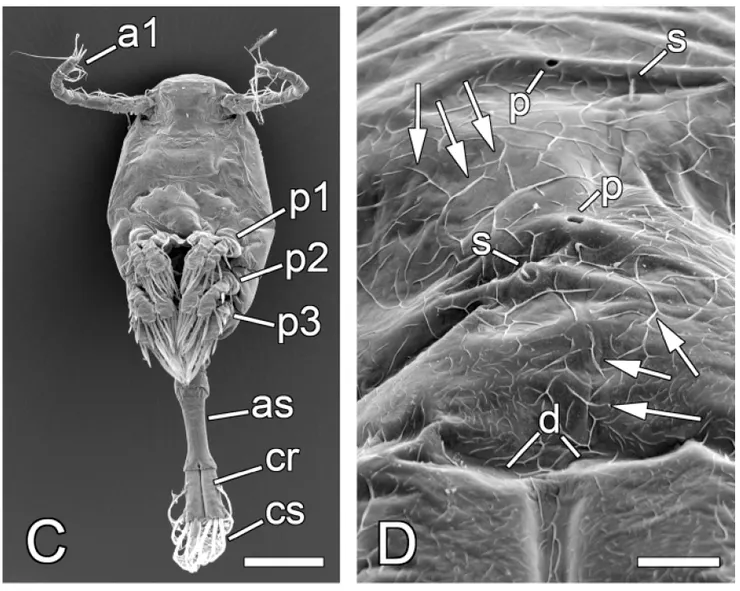 電子顯微鏡下的橈腳先生 和他保養得不太好的皮膚....
