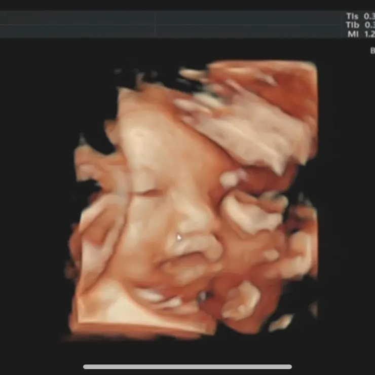 4D超音波好療癒啊～～