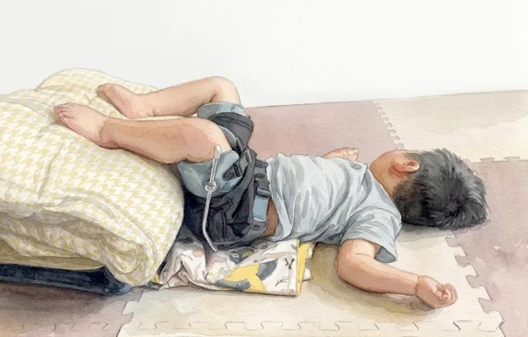 穿swash支架後，用枕頭和被子把腳墊高，讓膝蓋在骨盆正上方，這是醫生說的髖關節正確位置。