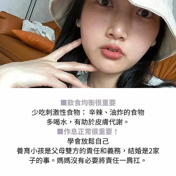 脂漏性皮膚炎保養推薦-肌密青春原液