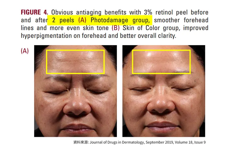 「A醇」現代抗老神器！