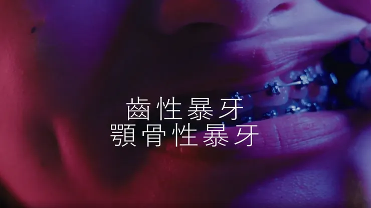 【什麼是齒暴？】牙齒暴牙不一定要開刀，搞懂齒性暴牙的關鍵！