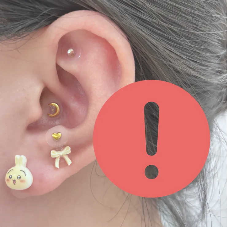 耳穴貼的注意事項與禁忌