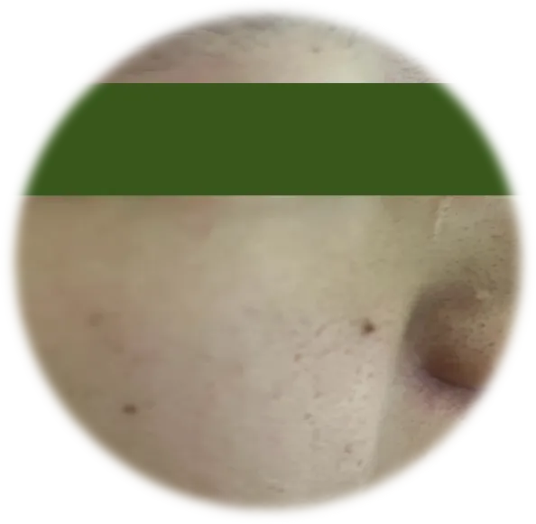 小山20歲的皮膚，除了鼻頭粉刺，應該還不錯吧...