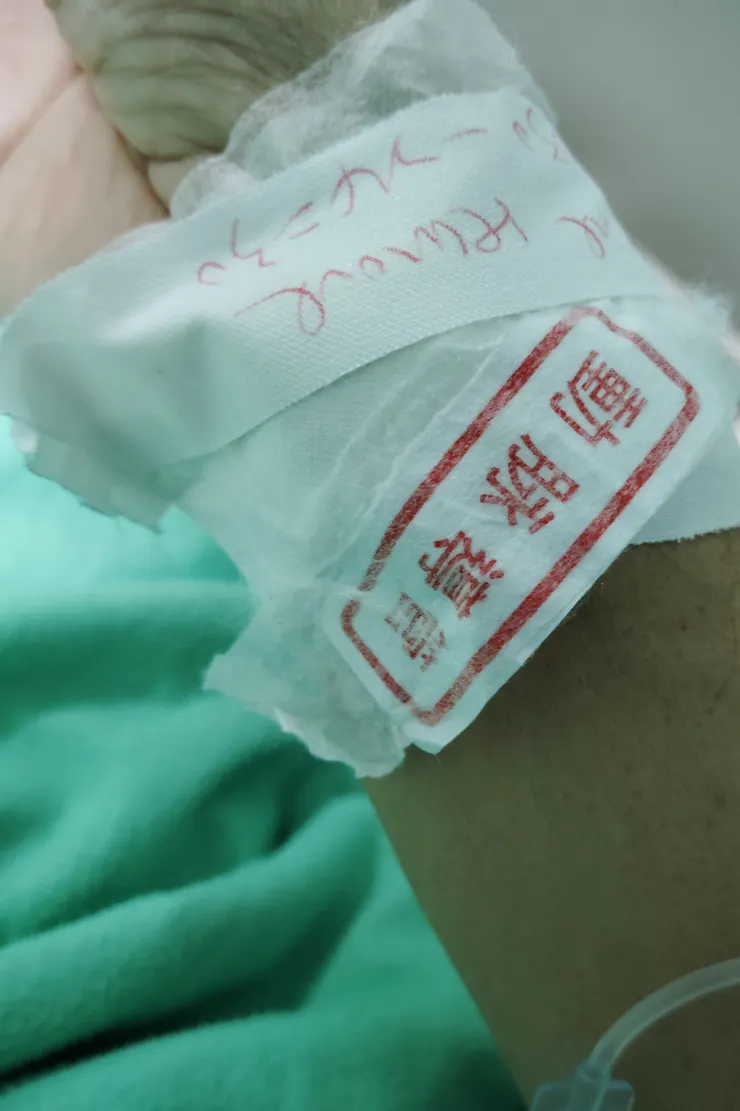 術後被插的其中一組引流管