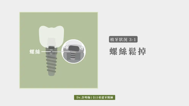第3-1種植牙狀況：螺絲鬆掉