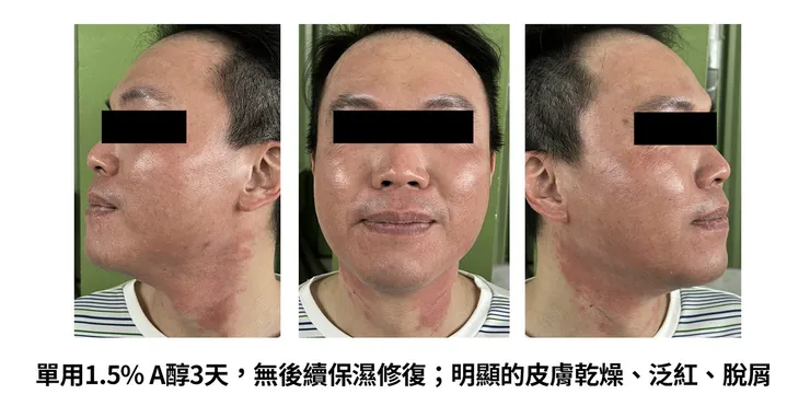 早C晚A 誰重要？兩大時機深入挑戰「早C好處」的保養計畫