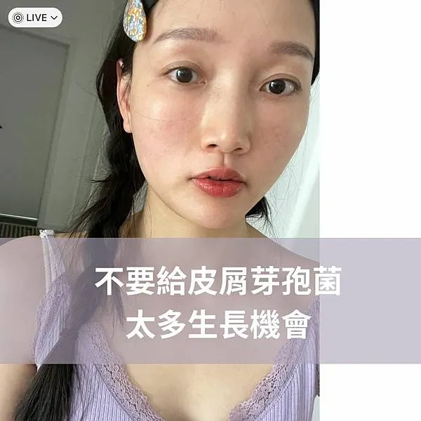 脂漏性皮膚炎、敏感肌怎麼保養