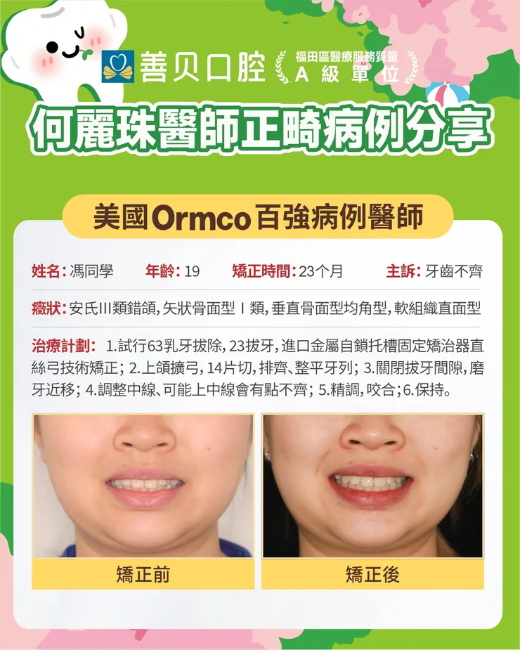 深圳善貝口腔倒及牙箍牙分享