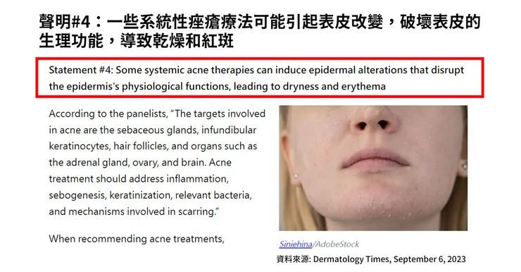 痘痘的起因曝光