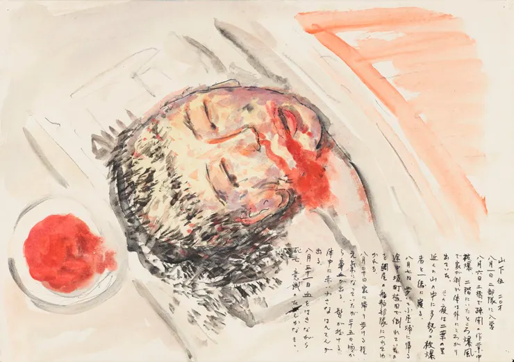 在吐血中斷氣的孩童。(山下正人作)
