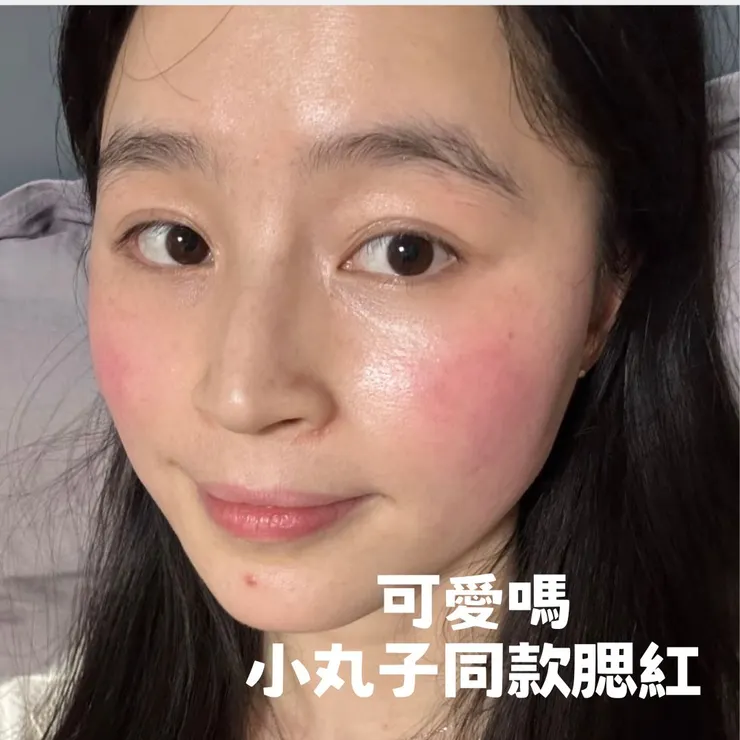 換季過敏熱潮紅