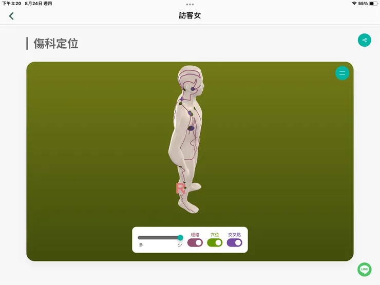 圖一:藍紫色經絡穴道堵塞的區位,含腋下+右胸肩+右肩胛+右後耳等