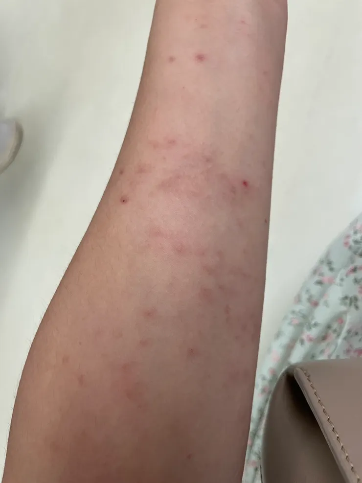 我現在的手臂