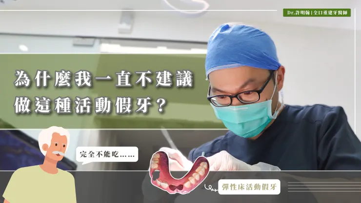 活動假牙選錯不能用？彈性床活動假牙、金屬鉤活動假牙的選擇