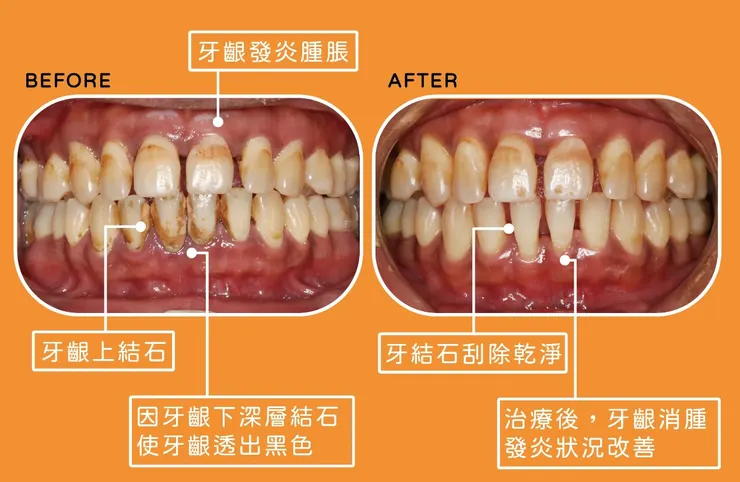 深圳牙科醫院推薦善貝口腔