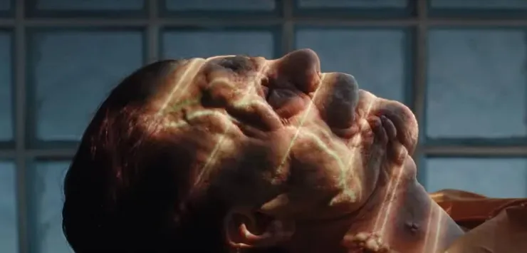 後來，Edward 接受了臉部重建手術，治好了他的缺陷。來源：《非常男人》電影劇照