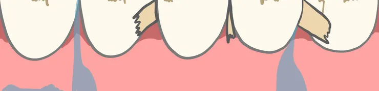 雞胸肉卡牙齒的痛苦(喔天啊