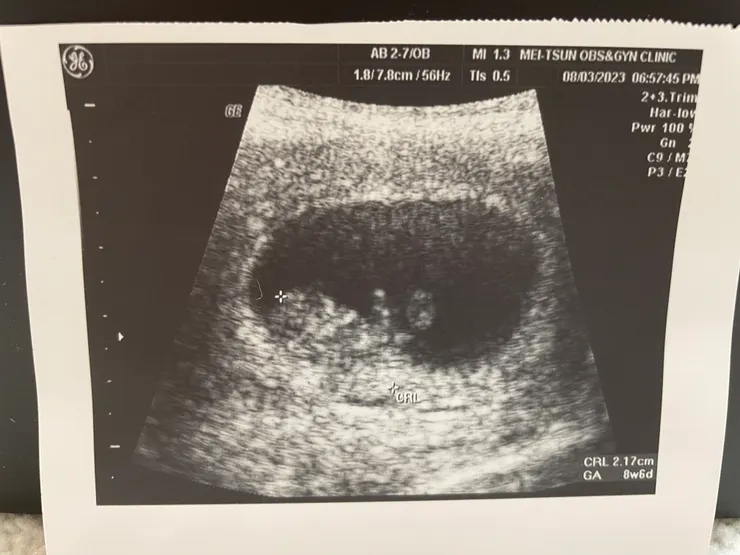 8W+6的小福氣~ 2.17cm