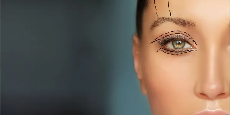 美麗的關鍵在眼睛！維美醫學雙眼皮手術和案例分享
