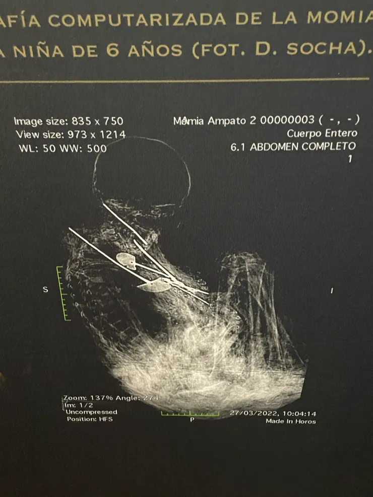 包裹的檢測照片