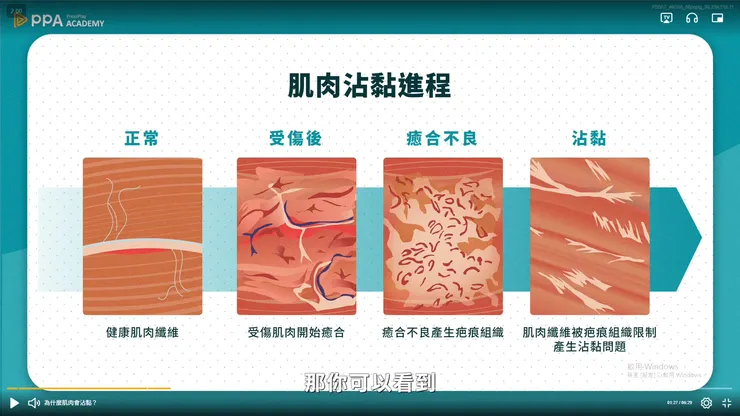 課程影片截圖 : 沾黏是怎麼回事