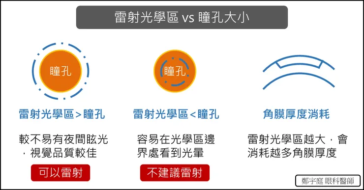 圖片來源：鄭宇庭眼科醫師