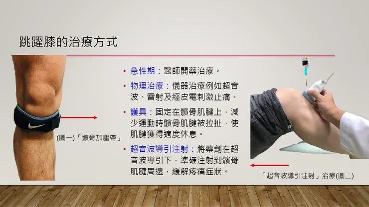 跳躍膝治療( 髕骨加壓帶 )