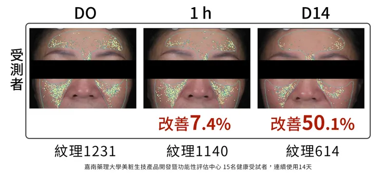 悶痘長不停怎麼辦?