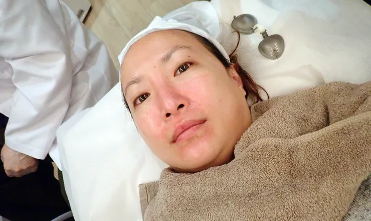 台北打皮秒│探索皮秒+蜂巢(超級鏡片ReFIX)-台北醫美診所推薦